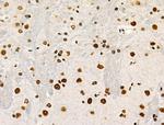 Phospho-POLR2A (Ser2, Ser1616) Antibody in Immunohistochemistry (Paraffin) (IHC (P))