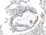 Phospho-POLR2A (Ser2, Ser1616) Antibody in Immunohistochemistry (Paraffin) (IHC (P))