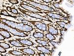 Phospho-POLR2A (Ser2, Ser1616) Antibody in Immunohistochemistry (Paraffin) (IHC (P))