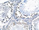 Phospho-POLR2A (Ser2, Ser1616) Antibody in Immunohistochemistry (Paraffin) (IHC (P))