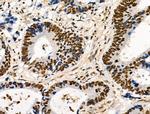 Phospho-POLR2A (Ser2, Ser1616) Antibody in Immunohistochemistry (Paraffin) (IHC (P))