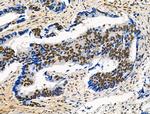 Phospho-POLR2A (Ser2, Ser1616) Antibody in Immunohistochemistry (Paraffin) (IHC (P))