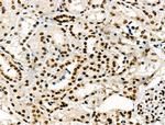 Phospho-POLR2A (Ser2, Ser1616) Antibody in Immunohistochemistry (Paraffin) (IHC (P))