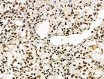 Phospho-POLR2A (Ser2, Ser1616) Antibody in Immunohistochemistry (Paraffin) (IHC (P))