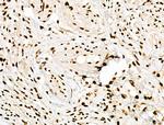 Phospho-POLR2A (Ser2, Ser1616) Antibody in Immunohistochemistry (Paraffin) (IHC (P))