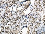 Phospho-POLR2A (Ser2, Ser1616) Antibody in Immunohistochemistry (Paraffin) (IHC (P))