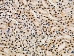 Phospho-POLR2A (Ser2, Ser1616) Antibody in Immunohistochemistry (Paraffin) (IHC (P))
