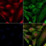 Phospho-PRK1/PRK2 (Thr774, Thr816) Polyclonal Antibody