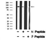 Phospho-PRK1/PRK2 (Thr774, Thr816) Antibody in Western Blot (WB)