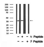 Phospho-C5AR1 (Ser334) Antibody in Western Blot (WB)
