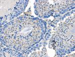 Phospho-ASAP2 (Ser701) Antibody in Immunohistochemistry (Paraffin) (IHC (P))