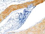 Phospho-ASAP2 (Ser701) Antibody in Immunohistochemistry (Paraffin) (IHC (P))