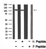 Phospho-ASAP2 (Ser701) Antibody in Western Blot (WB)