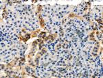 Phospho-DOK2 (Tyr139) Antibody in Immunohistochemistry (Paraffin) (IHC (P))
