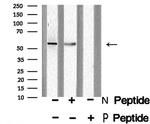 Phospho-DOK2 (Tyr139) Antibody in Western Blot (WB)
