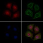 Phospho-HDAC7 (Ser486) Antibody in Immunocytochemistry (ICC/IF)