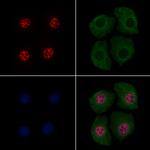 Phospho-p130 (Thr642) Polyclonal Antibody