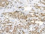 Phospho-p130 (Thr642) Antibody in Immunohistochemistry (Paraffin) (IHC (P))
