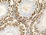 Phospho-p130 (Thr642) Antibody in Immunohistochemistry (Paraffin) (IHC (P))