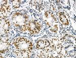 Phospho-p130 (Thr642) Antibody in Immunohistochemistry (Paraffin) (IHC (P))
