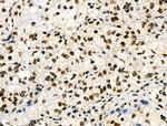 Phospho-p130 (Thr642) Antibody in Immunohistochemistry (Paraffin) (IHC (P))