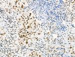 Phospho-p130 (Thr642) Antibody in Immunohistochemistry (Paraffin) (IHC (P))