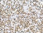 Phospho-p130 (Thr642) Antibody in Immunohistochemistry (Paraffin) (IHC (P))