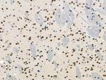 Phospho-p130 (Thr642) Antibody in Immunohistochemistry (Paraffin) (IHC (P))
