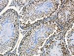 Phospho-p130 (Thr642) Antibody in Immunohistochemistry (Paraffin) (IHC (P))