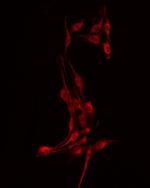 Phospho-VASP (Thr278) Antibody in Immunocytochemistry (ICC/IF)