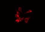 Phospho-CSF1R (Tyr921) Antibody in Immunocytochemistry (ICC/IF)