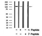 Phospho-EphA3 (Tyr602) Antibody in Western Blot (WB)
