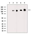 Phospho-EphA5 (Tyr650) Polyclonal Antibody