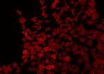 Phospho-EphB1/EphB2 (Tyr778, Tyr780) Antibody in Immunocytochemistry (ICC/IF)