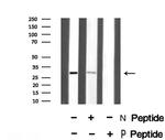 Phospho-LAT (Tyr255) Antibody in Western Blot (WB)
