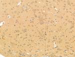 Phospho-ALK (Tyr1078) Polyclonal Antibody