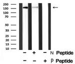 Phospho-ALK (Tyr1078) Antibody in Western Blot (WB)