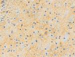 Phospho-AP2M1 (Thr156) Polyclonal Antibody