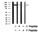 Phospho-Amyloid Precursor Protein (Thr729) Antibody in Western Blot (WB)
