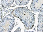 Phospho-SMC3 (Ser1067) Antibody in Immunohistochemistry (Paraffin) (IHC (P))