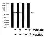 Phospho-CD19 (Tyr500) Antibody in Western Blot (WB)