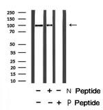 Phospho-HSP105 (Ser809) Antibody in Western Blot (WB)