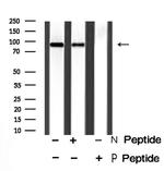 Phospho-NHE3 (Ser555) Antibody in Western Blot (WB)