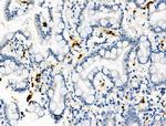 Phospho-RRAS (Tyr66) Antibody in Immunohistochemistry (Paraffin) (IHC (P))