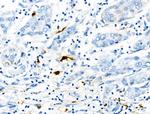 Phospho-S100A9 (Thr113) Polyclonal Antibody
