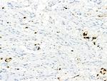 Phospho-S100A9 (Thr113) Antibody in Immunohistochemistry (Paraffin) (IHC (P))
