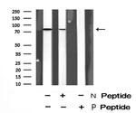 Phospho-Synapsin II (Ser425) Antibody in Western Blot (WB)
