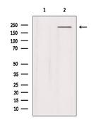 SCN9A Polyclonal Antibody