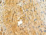 PTRF Antibody in Immunohistochemistry (Paraffin) (IHC (P))