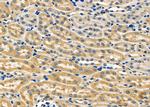 SFRP1 Polyclonal Antibody